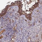 C4BPB Polyclonal Antibody