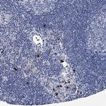 VPS13D Antibody in Immunohistochemistry (IHC)