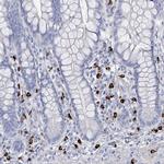 VPS13D Polyclonal Antibody