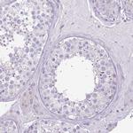 HOXC13 Polyclonal Antibody