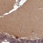 PUS1 Polyclonal Antibody