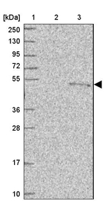 PUS1 Antibody in Western Blot (WB)