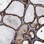 SHROOM2 Antibody in Immunohistochemistry (Paraffin) (IHC (P))