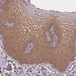 RPL24 Antibody in Immunohistochemistry (Paraffin) (IHC (P))