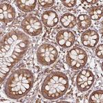 RPL24 Antibody in Immunohistochemistry (Paraffin) (IHC (P))