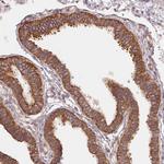 RPL24 Antibody in Immunohistochemistry (Paraffin) (IHC (P))