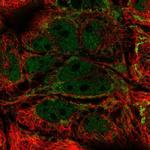 MRPL21 Polyclonal Antibody