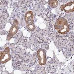MRPL21 Antibody in Immunohistochemistry (IHC)