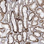 ALG12 Polyclonal Antibody