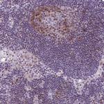 PQLC1 Antibody in Immunohistochemistry (IHC)