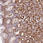 STK35 Polyclonal Antibody