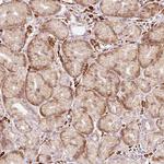 RANBP2 Antibody in Immunohistochemistry (Paraffin) (IHC (P))