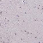 HMCN1 Antibody in Immunohistochemistry (Paraffin) (IHC (P))