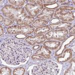 HMCN1 Antibody in Immunohistochemistry (Paraffin) (IHC (P))