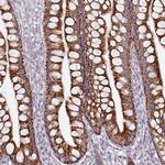 HMCN1 Polyclonal Antibody