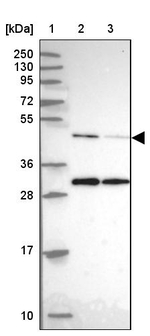 Arp3 Antibody in Western Blot (WB)
