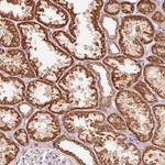 C17orf98 Antibody in Immunohistochemistry (Paraffin) (IHC (P))