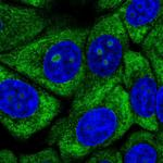 RPL13 Polyclonal Antibody