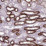 PRAMEF7 Antibody in Immunohistochemistry (Paraffin) (IHC (P))