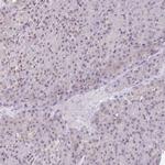 FAM32A Antibody in Immunohistochemistry (Paraffin) (IHC (P))
