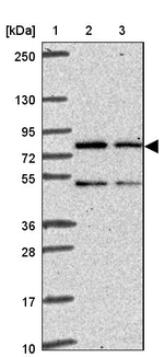 TTC30A Antibody in Western Blot (WB)