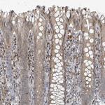 RHPN2 Antibody in Immunohistochemistry (IHC)