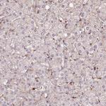 CHMP4B Antibody in Immunohistochemistry (IHC)