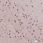 CHMP4B Antibody in Immunohistochemistry (IHC)