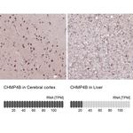 CHMP4B Antibody