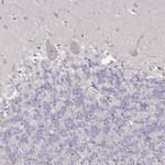 RPL23A Antibody in Immunohistochemistry (Paraffin) (IHC (P))