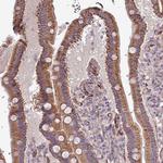 RPL23A Polyclonal Antibody