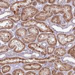 RPL23A Antibody in Immunohistochemistry (Paraffin) (IHC (P))
