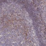 RPL23A Antibody in Immunohistochemistry (IHC)