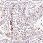 TDRD15 Polyclonal Antibody