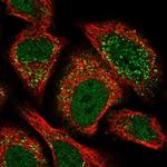 ACBD4 Polyclonal Antibody