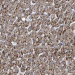 ACBD4 Antibody in Immunohistochemistry (Paraffin) (IHC (P))