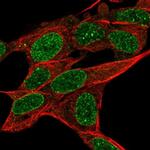 RADIL Polyclonal Antibody