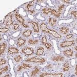 RADIL Antibody in Immunohistochemistry (Paraffin) (IHC (P))