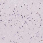 Smoothelin Antibody in Immunohistochemistry (Paraffin) (IHC (P))