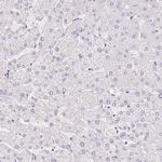 Smoothelin Antibody in Immunohistochemistry (Paraffin) (IHC (P))