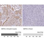 Smoothelin Antibody in Immunohistochemistry (IHC)