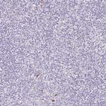 Smoothelin Antibody in Immunohistochemistry (IHC)