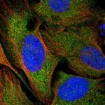 CCDC121 Polyclonal Antibody