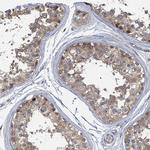 CCDC121 Antibody in Immunohistochemistry (Paraffin) (IHC (P))