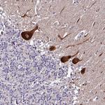 GRAPL Polyclonal Antibody