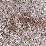 FNDC4 Polyclonal Antibody
