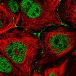 IGSF23 Polyclonal Antibody