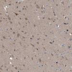 DPM1 Antibody in Immunohistochemistry (Paraffin) (IHC (P))