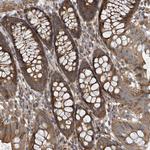 DPM1 Antibody in Immunohistochemistry (Paraffin) (IHC (P))