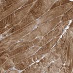 DPM1 Antibody in Immunohistochemistry (Paraffin) (IHC (P))